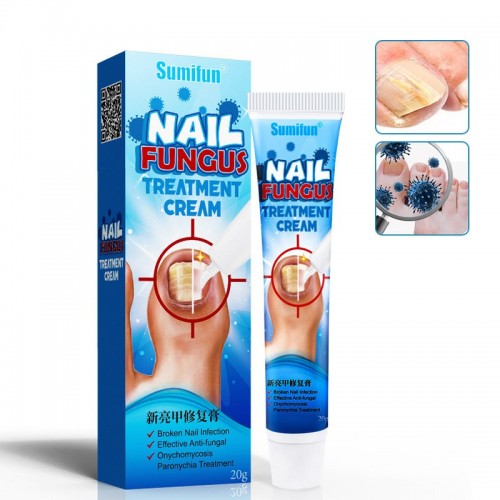 Купить крем от ногтевого грибка “NAIL FUNGUS”